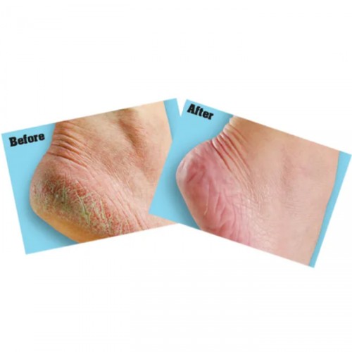 OKEEFFES HEALTHY FEET FOOT CREAM 91G